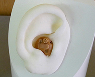耳穴型